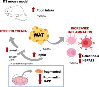 Down Syndrome Is a Metabolic Disease: Altered Insulin Signaling Mediates Peripheral and Brain Dysfunctions